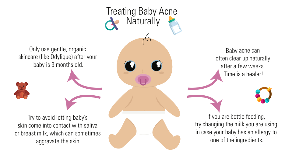 Baby Acne 101 The Natural Approach