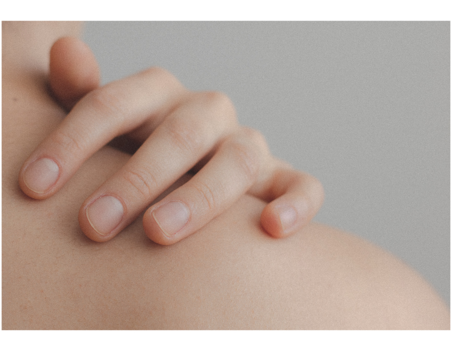 Radiation Burns Natural Ways to Soothe Sore Skin